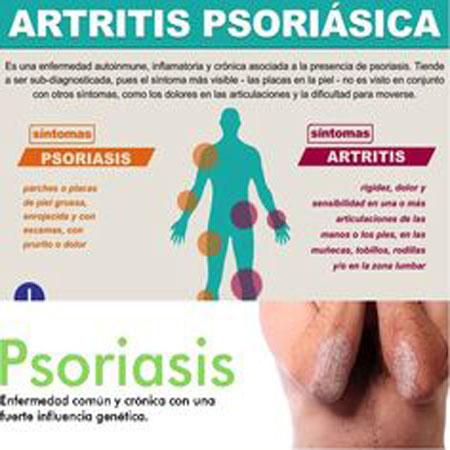 apsoriasica